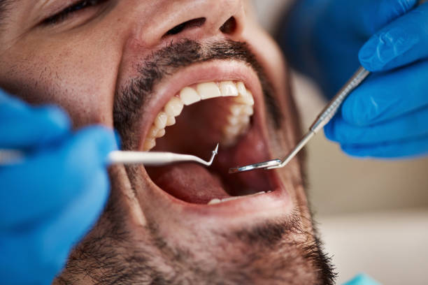 Best Broken or Chipped Tooth Repair in Riverview, MI